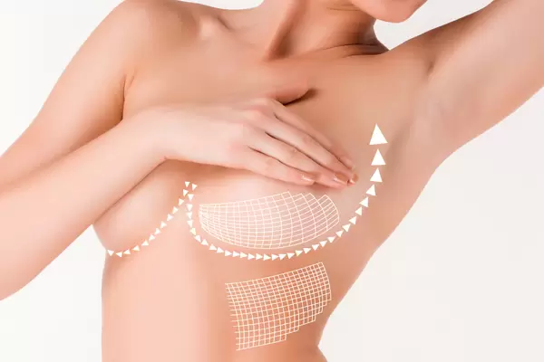 果凍隆乳/魔D隆乳/胸部整形