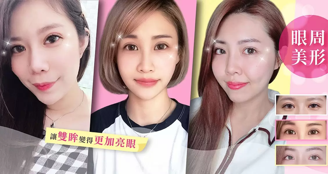 眼周整形 / 雙眼皮 / 眼袋