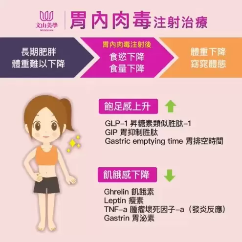 【胃內肉毒注射治療】