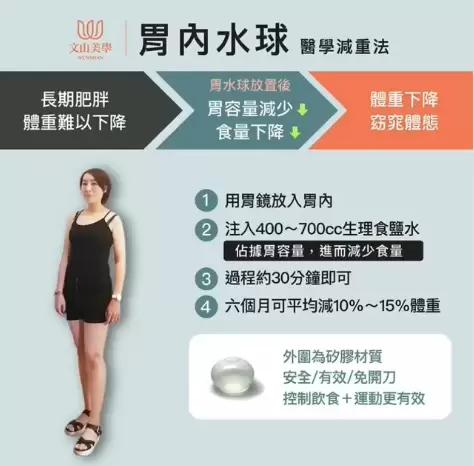 【胃內水球醫學減重法】