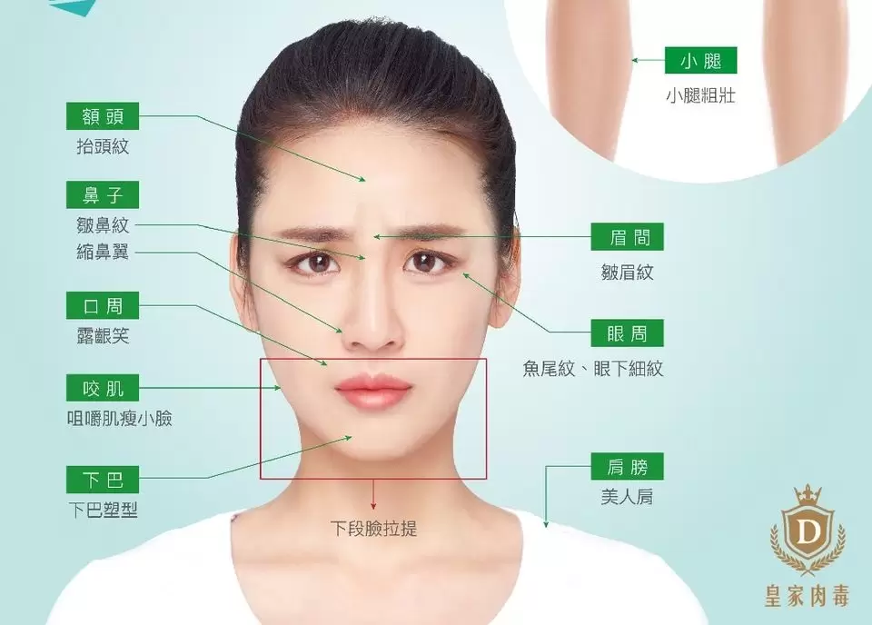 美麗無需等待-皇家肉毒