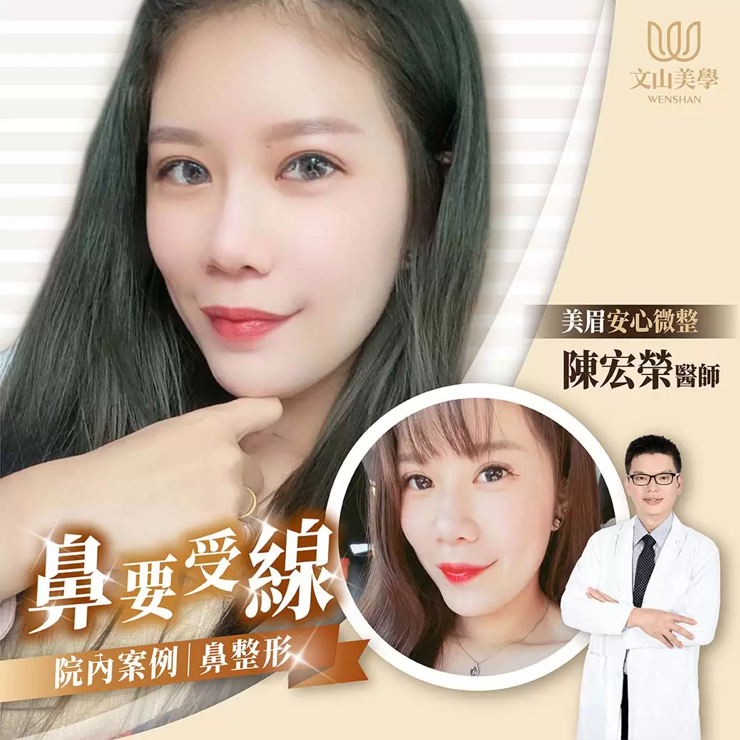 【陳宏榮醫師】量身打造鼻(不)要受線(限) 微整形