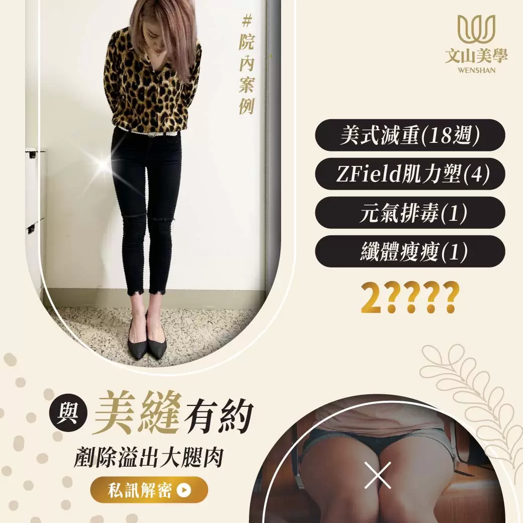 希望剷除溢出的大腿肉，穿個牛仔褲就很好看嗎?【與『美縫』有約】
