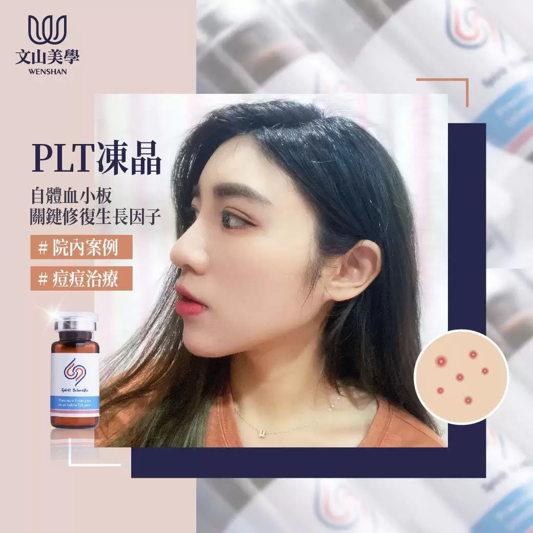 PLT凍晶 自體血小板關鍵修復生長因子改善膚質