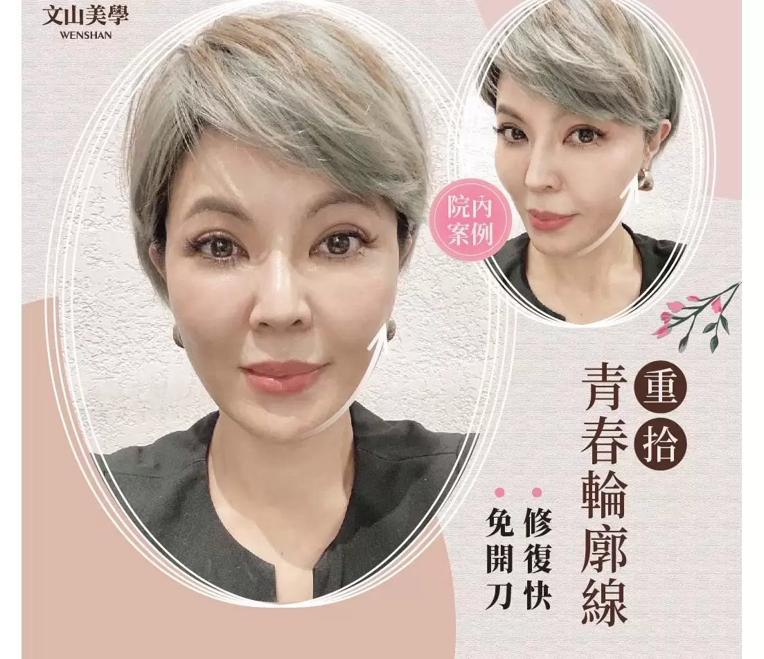 【MINT神力拉提】獨家專利技術，讓拉提更有感！