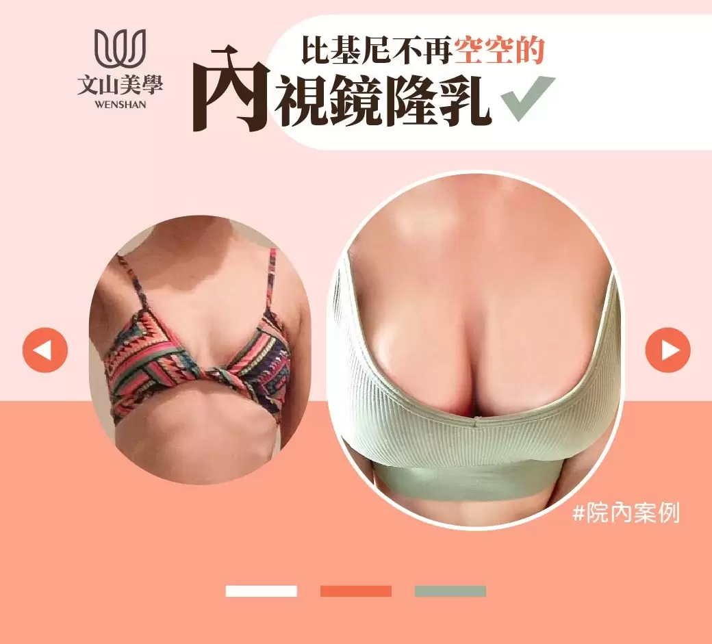 高雄整形外科 黃士財醫師X鄭鴻宜醫師 攜手客製化內視鏡隆乳