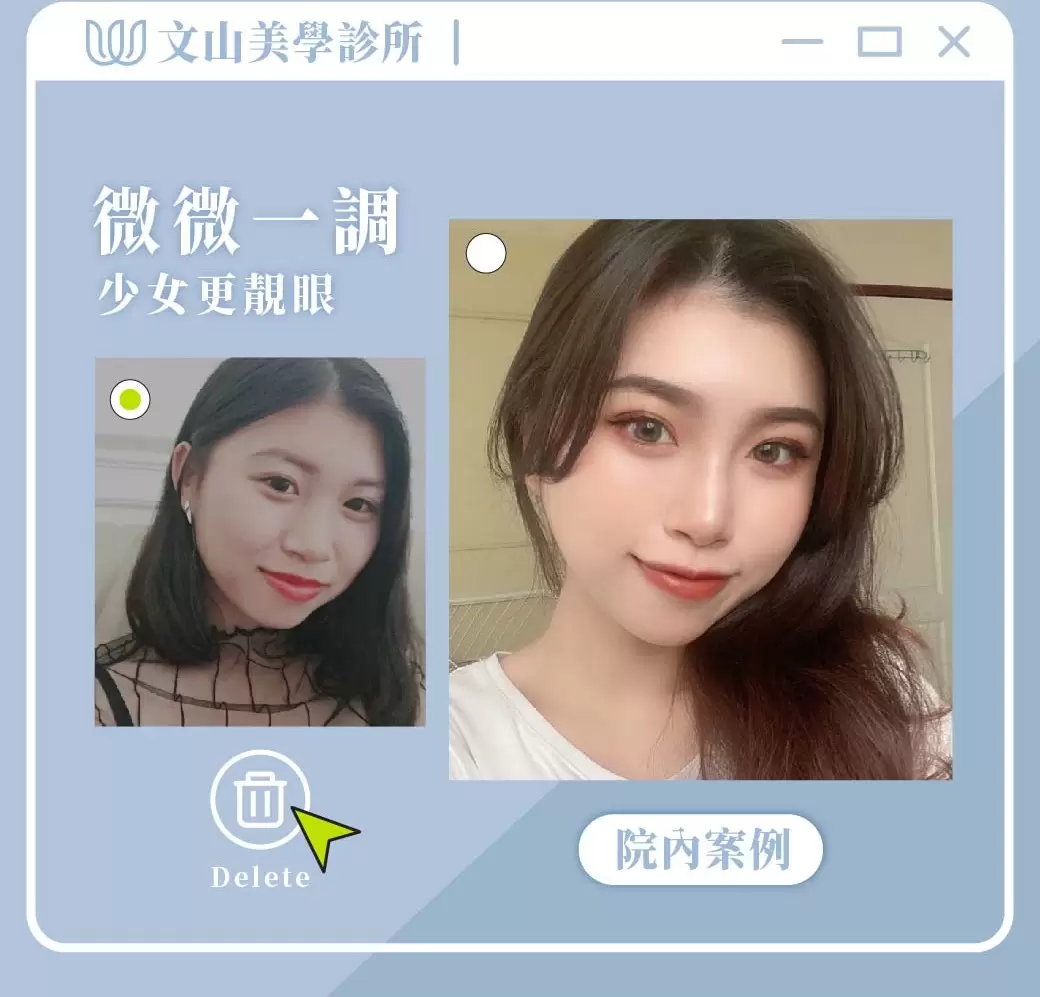 看得出來這位美女微調了什麼地方嗎？