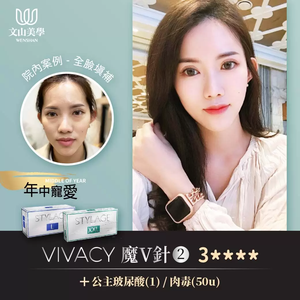 年中寵愛【魔V輪廓宛如天生】院內案例 全臉填補