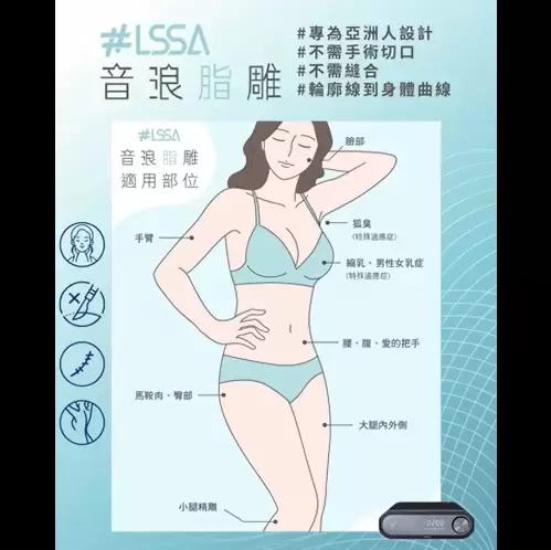 LSSA音浪脂雕 脂肪新天敵