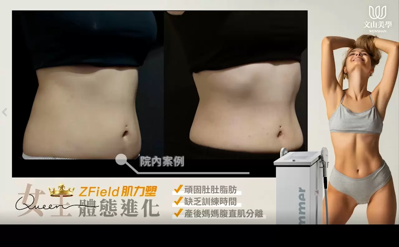 肌力塑 完成你的女王體態『馬甲夢』