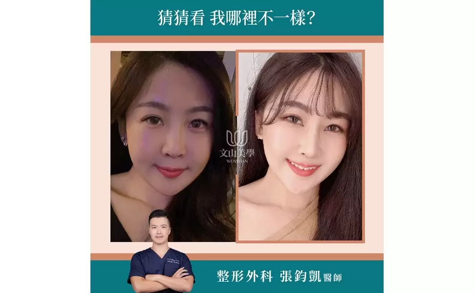 哪裡不一樣？大家來找找~高雄整形外科張鈞凱醫師專業客製化