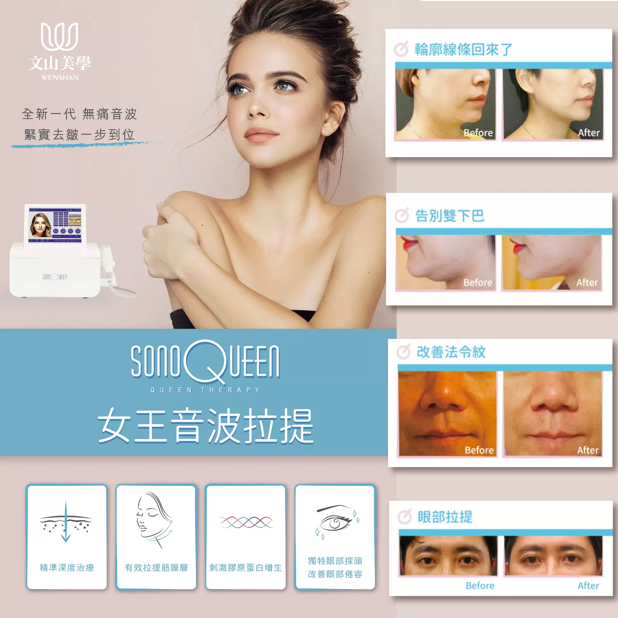 治療老化必須從深層開始【女王音波新機登場】