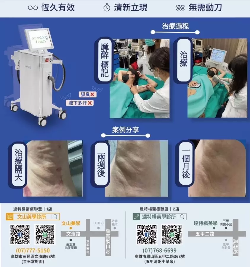 高雄狐臭多汗問題，清新微波熱能止汗術miraDry®都解決了