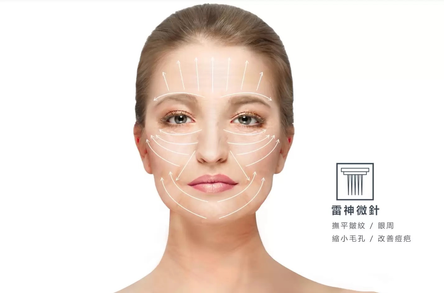 雷神微針x閃電音波 由內而外 雙重聚焦 膚質改善 緊緻拉提 撫平紋路