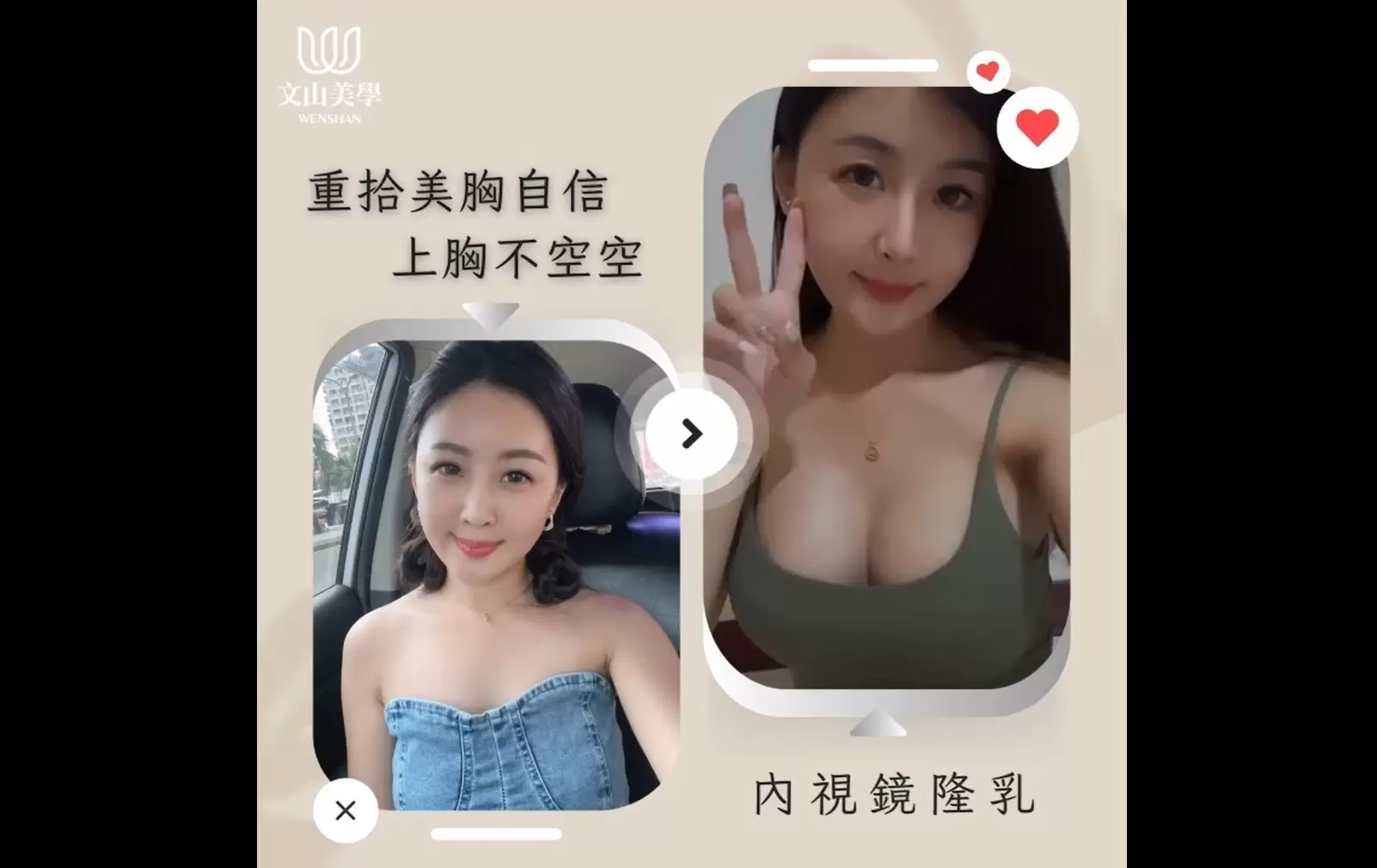 內視鏡隆乳｜精準、安全、自然的美胸選擇