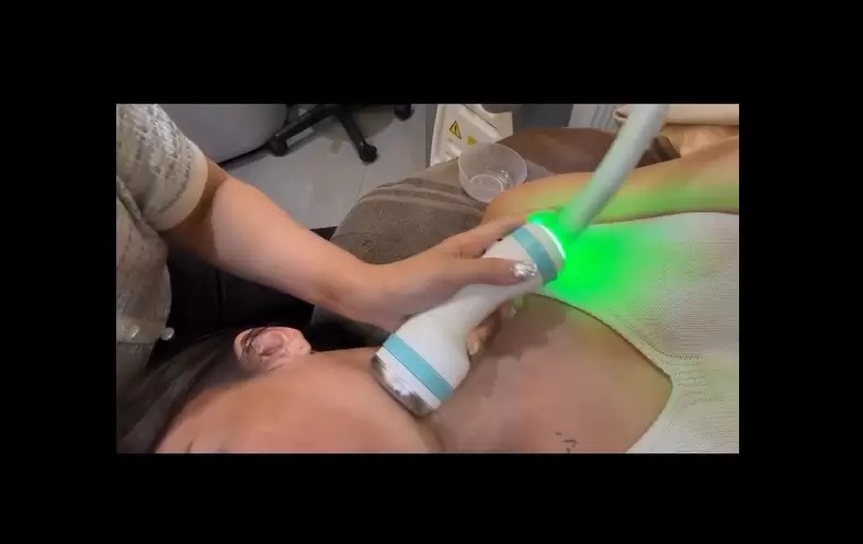 昂達ONDA超微波讓鬆垮肉鬆臉乾淨俐落的輪廓線條貼骨浮現