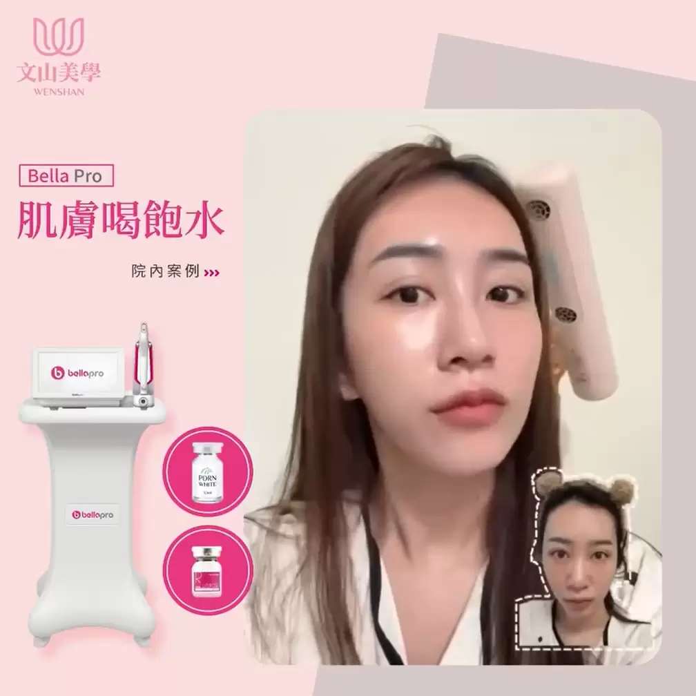 水光肌革命 不只肌膚內在飽水 外在水嫩透亮閃閃發光