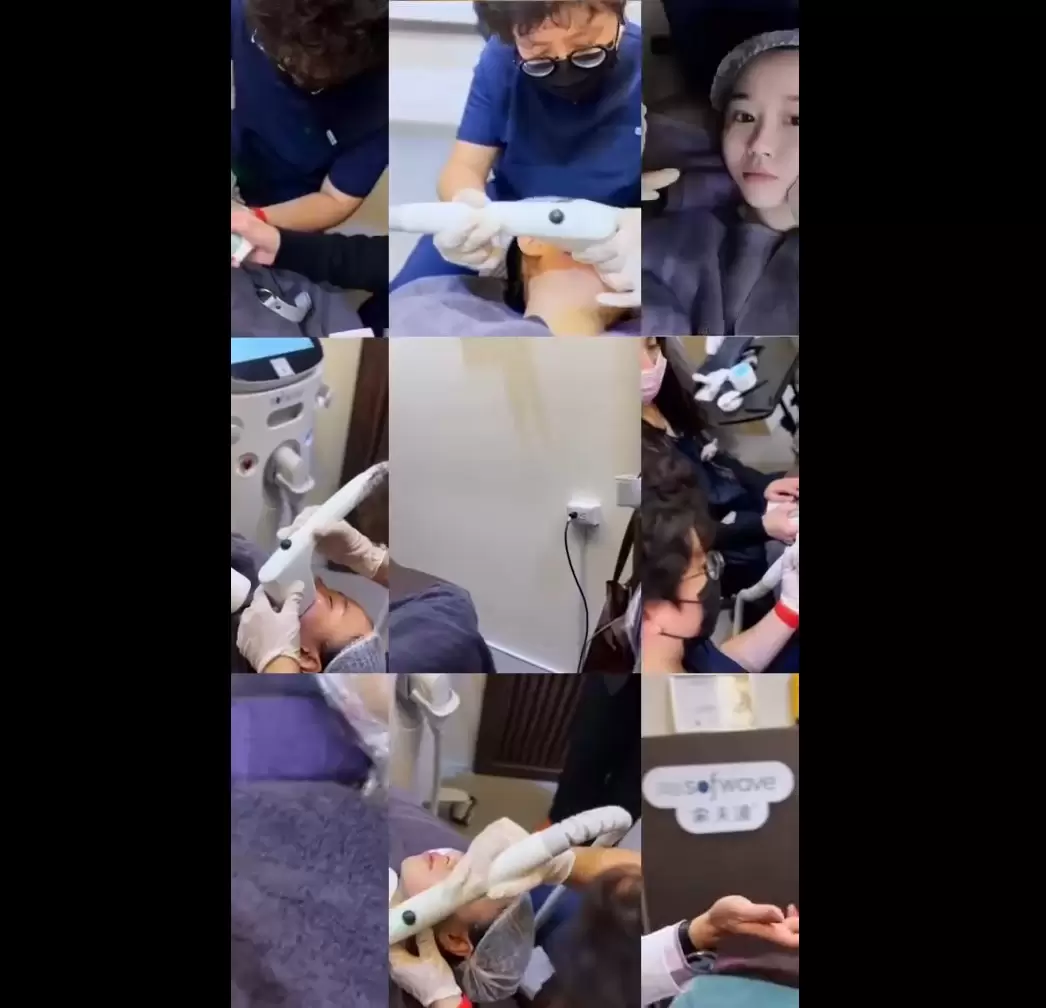 Sofwave索夫波 電波緊緻 音波拉提 雙重效果 改善鬆弛紋路 重現緊緻輪廓線