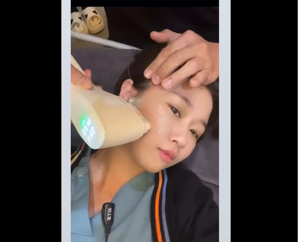 「Z音波」Q+立線音波升級版 LINEAR Z 改善肌膚鬆垮垂問題