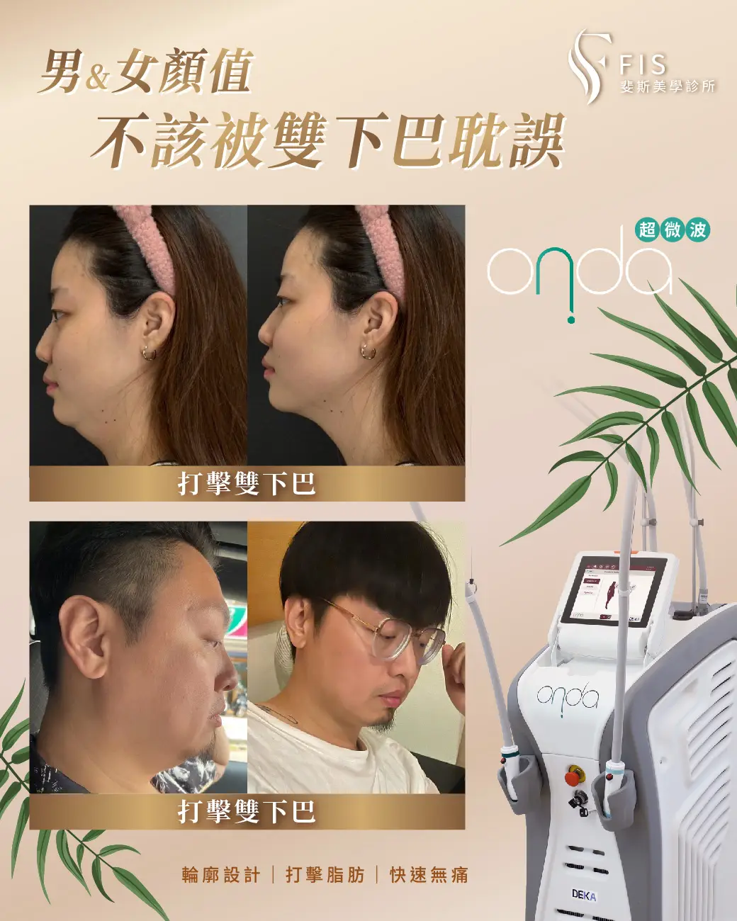 昂達超微波ONDA｜把藏起來的線條，還給你