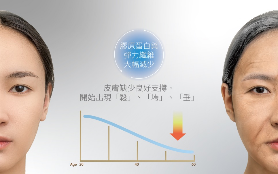 臉上眼周細紋、皺紋、法令紋、雙下巴等問題逐年齡增長漸漸浮現，還有輪廓線條都會引響。